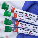 Honduras instala salas de vigilancia epidemiológica para detectar posibles casos de mpox (viruela del mono)