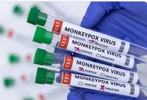 Honduras instala salas de vigilancia epidemiológica para detectar posibles casos de mpox (viruela del mono)